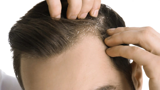 Top 5 Hair Myths Every Man Should Stop Believing