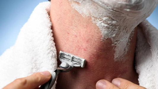 How Can Men Prevent Razor Burn?