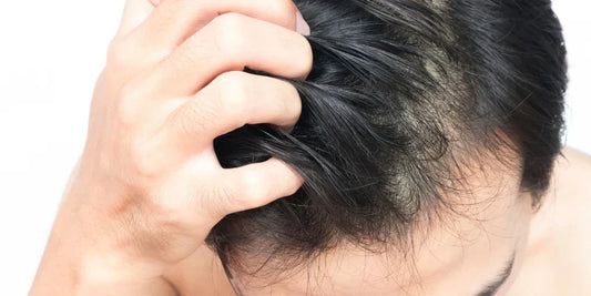 5 Ways to Tell If Your Scalp Is Irritated by Your Products